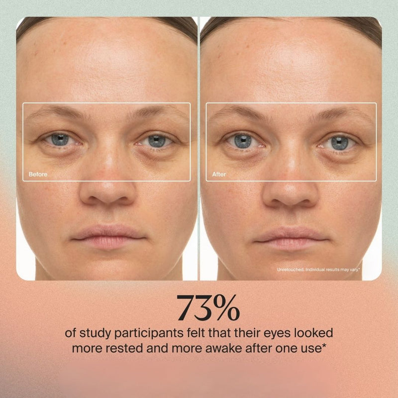 Nuvio 6-in-1 Anti-Aging Wand